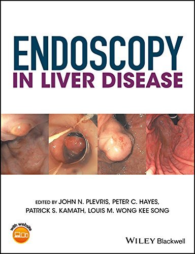 Endoscopy in Liver Disease 1st Edition