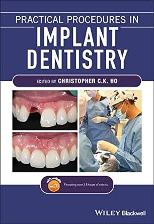 Practical Procedures in Implant Dentistry 1st Edition